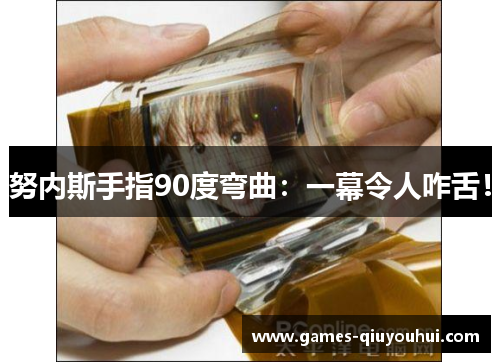 努内斯手指90度弯曲：一幕令人咋舌！
